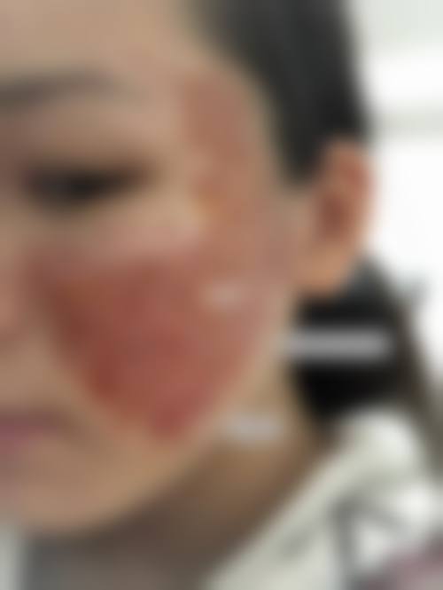 大庆和美家整形医院预约挂号方式。