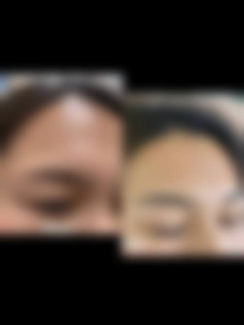 大庆和美家整形医院擅长项目。