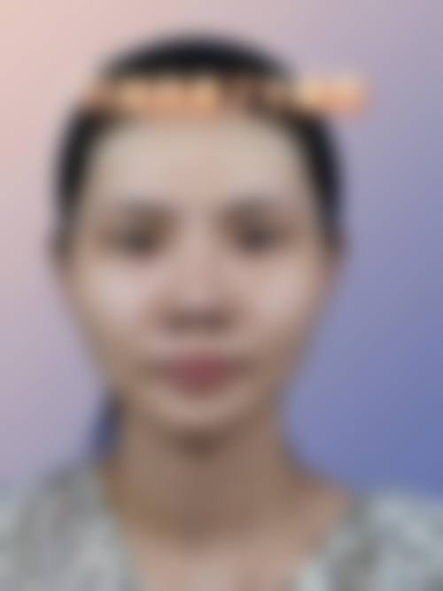 成都川美医疗美容诊所2026年价格收费表: