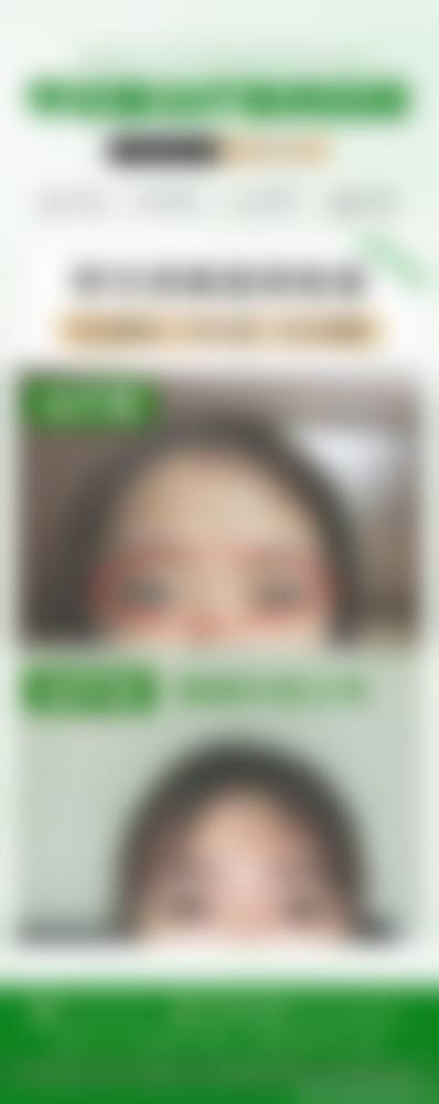 内蒙古自治区妇幼保健院眼科医生团队经验稳定。