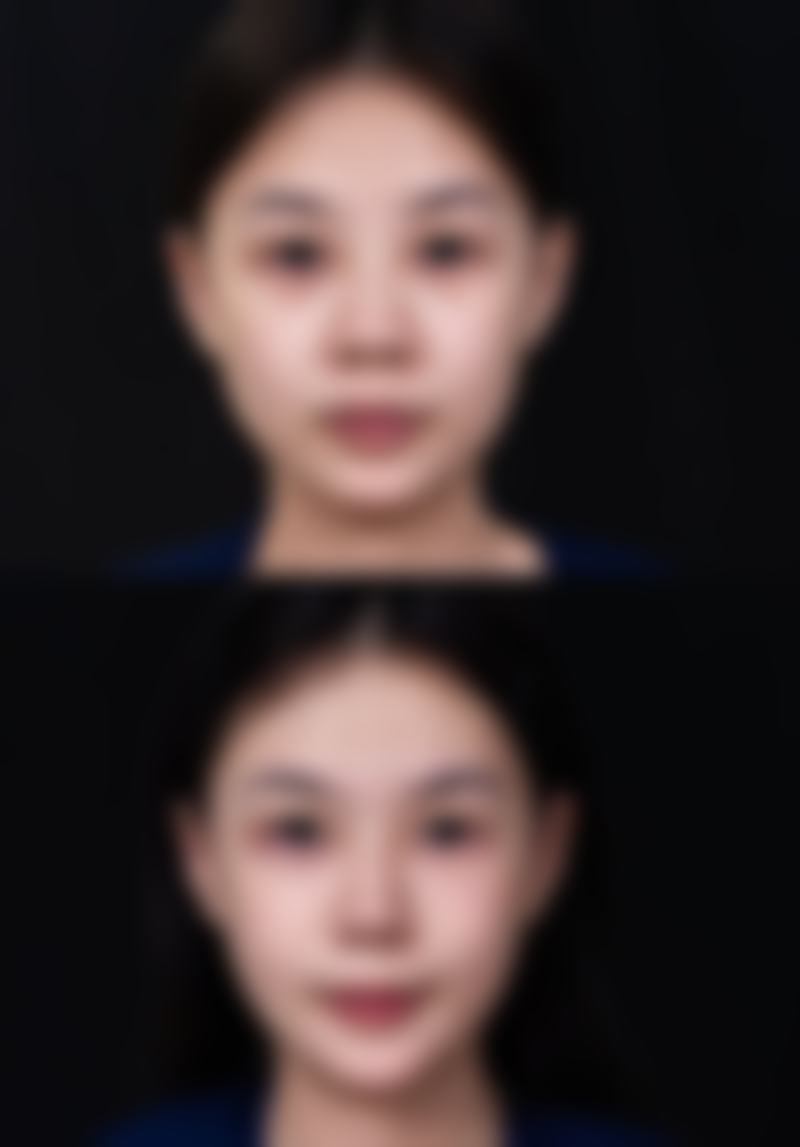 李愚炅擅长的治疗项目