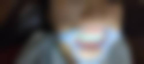 岳阳云溪欣意口腔擅长项目。