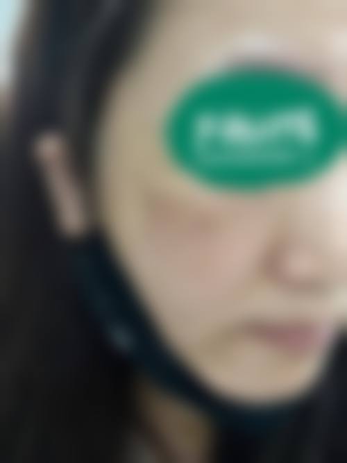 合肥曼美医疗美容诊所2026年价格收费表: