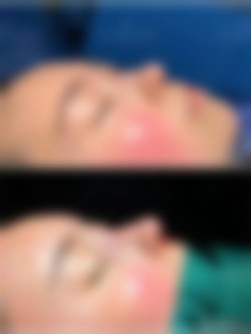 合肥曼美医疗美容诊所擅长项目。