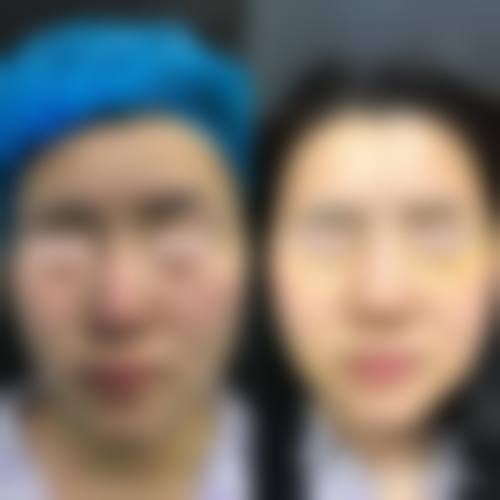 优惠活动详情:限时特别优惠,品质保护