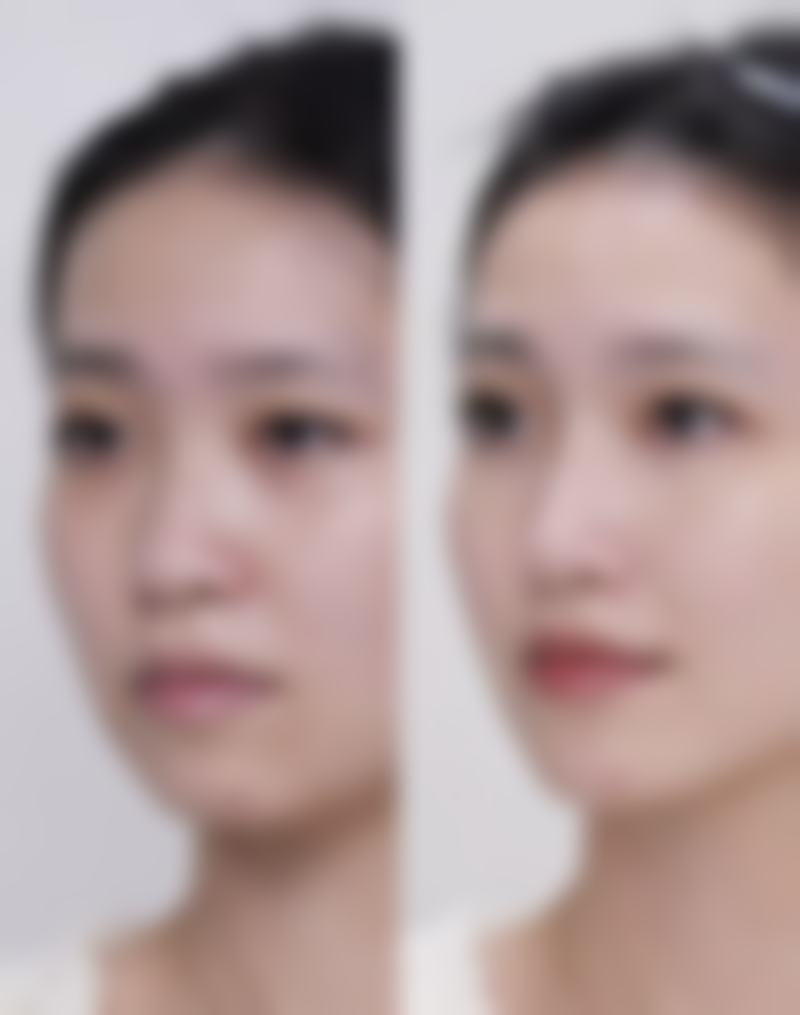 临床实例分享
