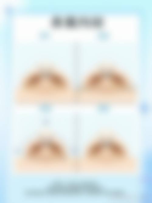 广州美妍整形擅长项目。