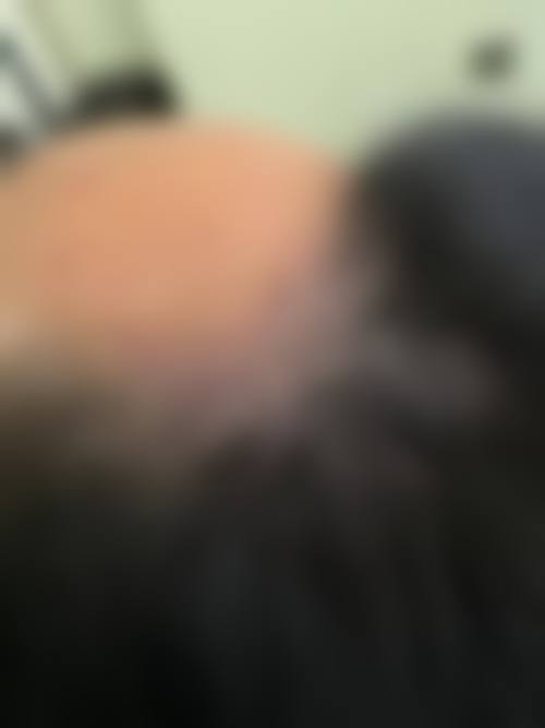 北京四季医疗美容诊所治疗反馈与口碑评价。