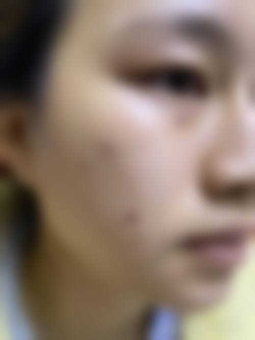 杭州4ever整形医院医生团队经验稳定。