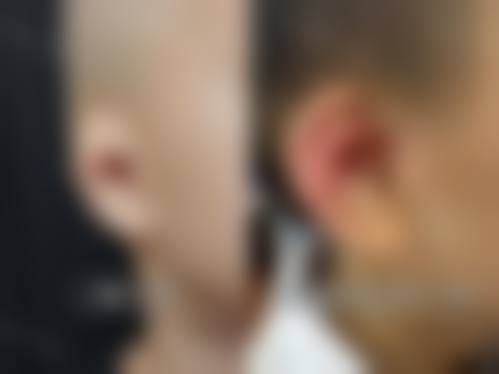 杭州4ever整形医院治疗反馈与口碑评价。