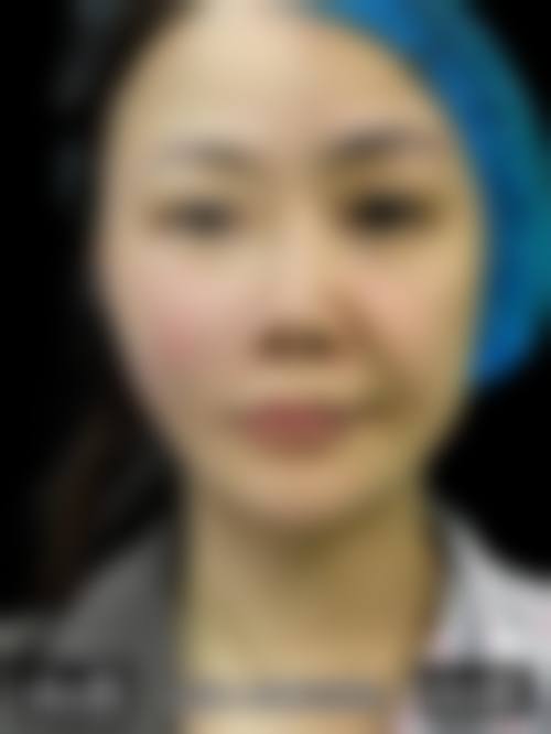 青岛昕晟美医疗美容诊所2026年价格收费表