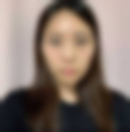 杭州4ever整形医院擅长项目。