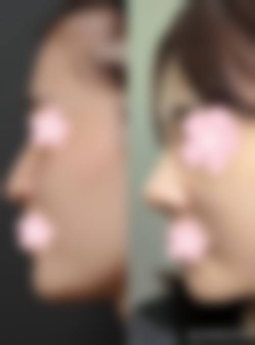 患者真实评价