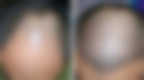 擅长项目详解