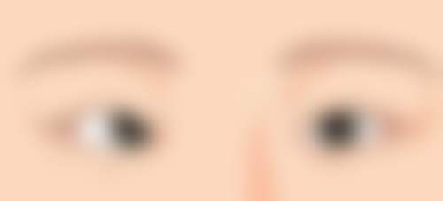 Q1:眼科检查可以用医疗保险吗?