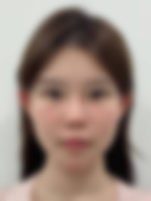 厦门沁和美整形医院治疗反馈与口碑评价