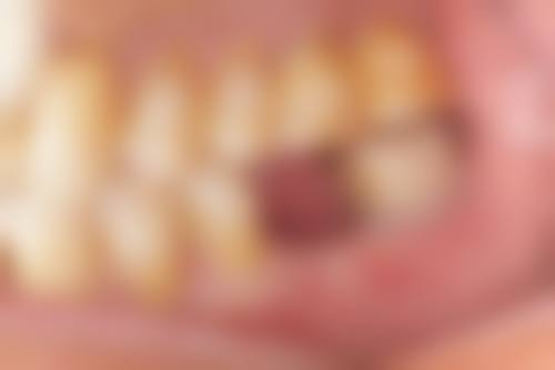 广东梅州立杨口腔预约挂号方式。