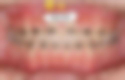核心诊疗项目:从种植到矫正,全方面解决口腔难题