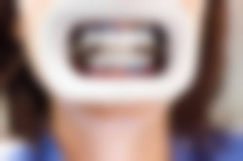 三、湖南长沙顺安口腔医生介绍