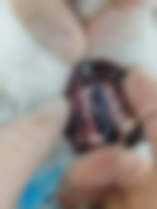 广州海珠诺德口腔门诊部擅长项目。