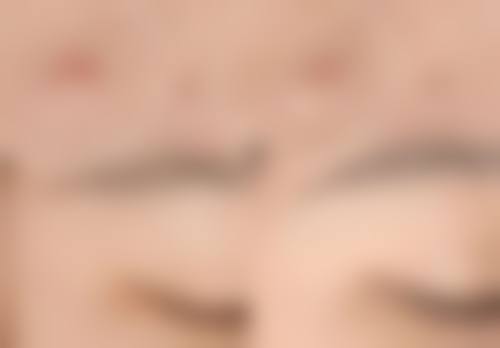 预约优惠活动:颜玉华医生的专属补贴