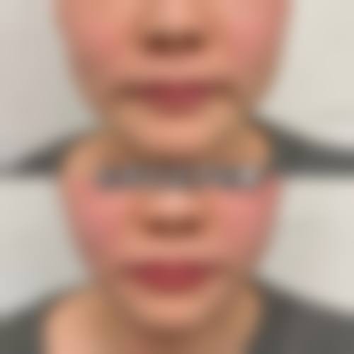 鞍山钢铁集团整形医疗美容医院预约挂号方式。