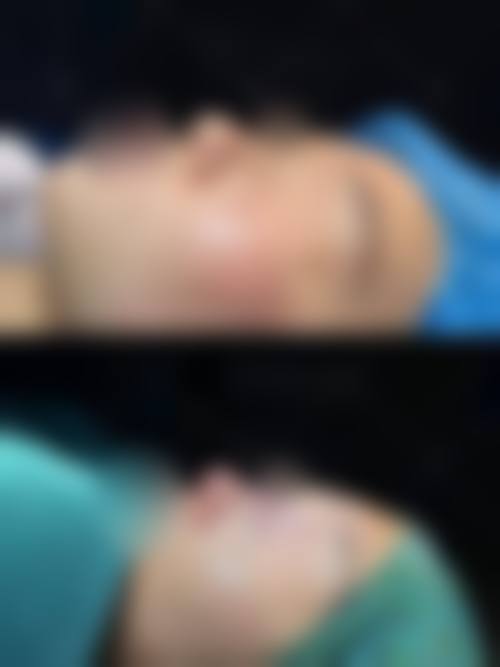 擅长项目详解:颜玉华医生的核心技术方向