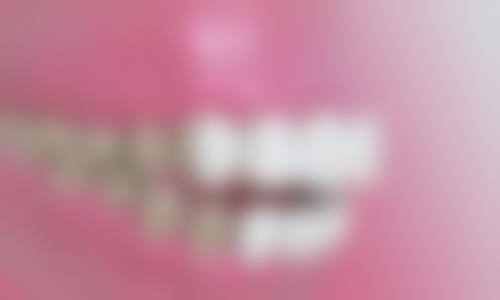 临床实例分享