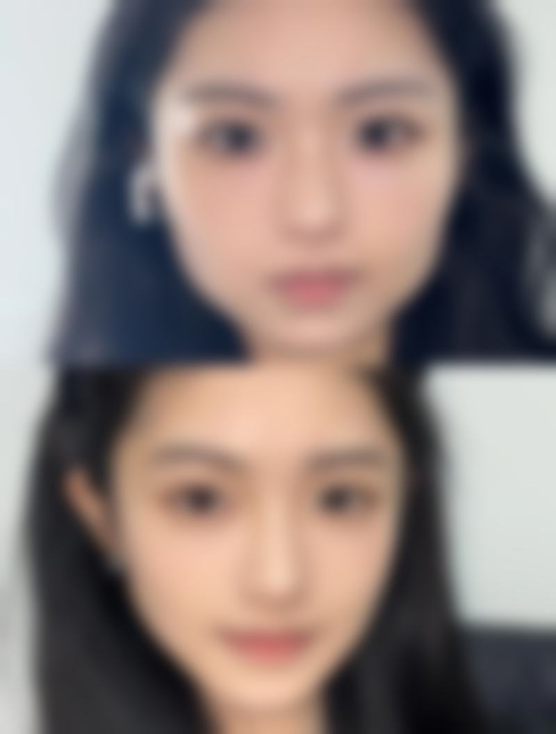 吕光全医生擅长项目