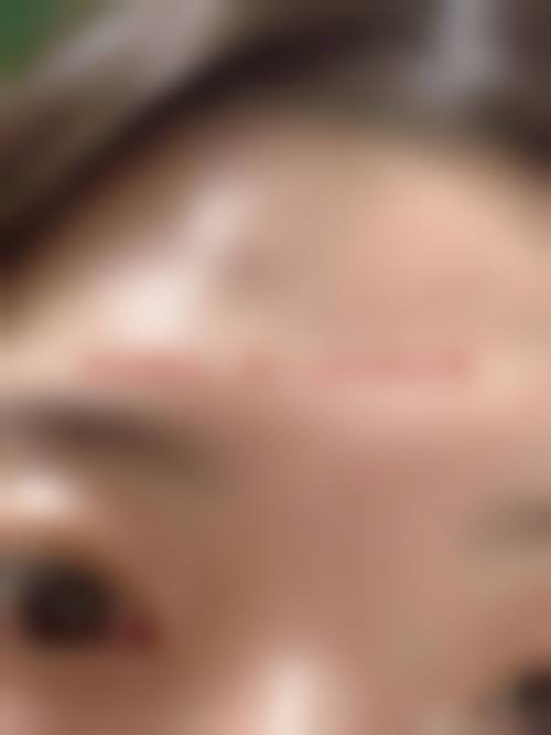 临床实例分享