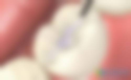浙江杭州艾牙口腔诊所擅长项目。