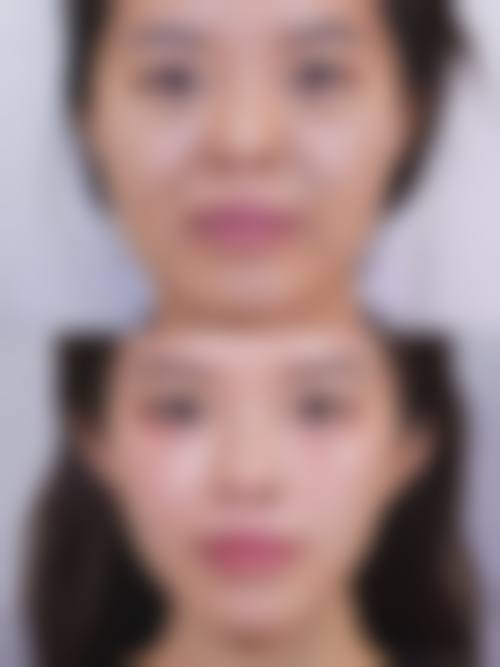 优惠活动详情