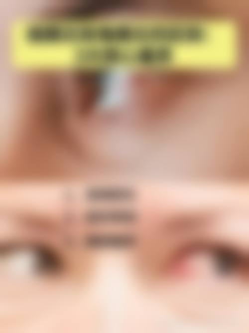 益阳市中 心医院眼科门诊营业时间。