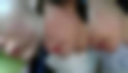 张掖蔚蓝十八度美容诊所擅长项目。