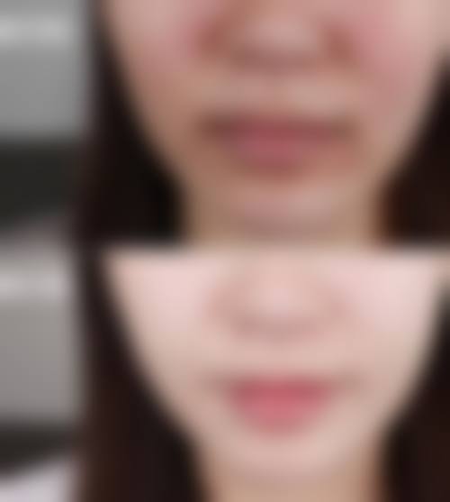 广西泰颜医疗美容门诊部治疗反馈与口碑评价。