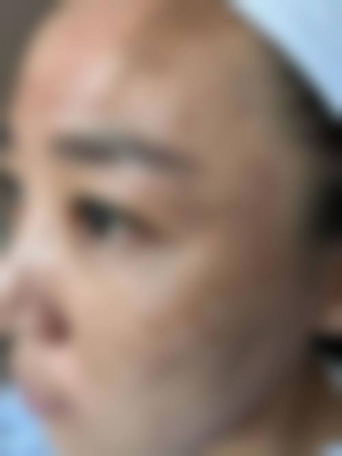 南京达特莱医疗美容诊所擅长项目。