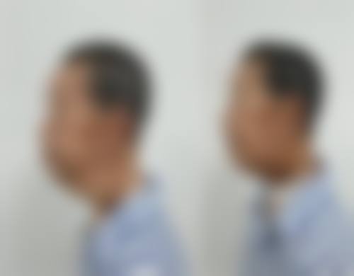 擅长项目详解：郭京玺面部年轻化与精细整形