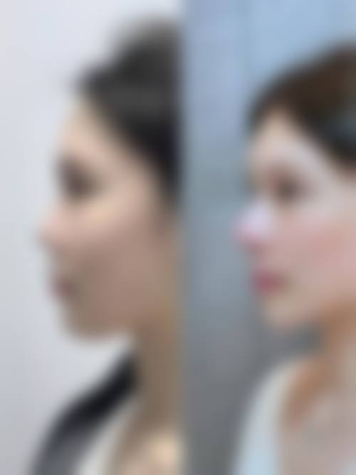 Q: TCB山形美容外科医院是正规医院吗?