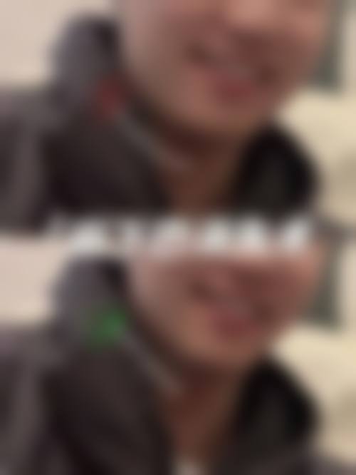 南京达特莱医疗美容诊所治疗反馈与口碑评价。