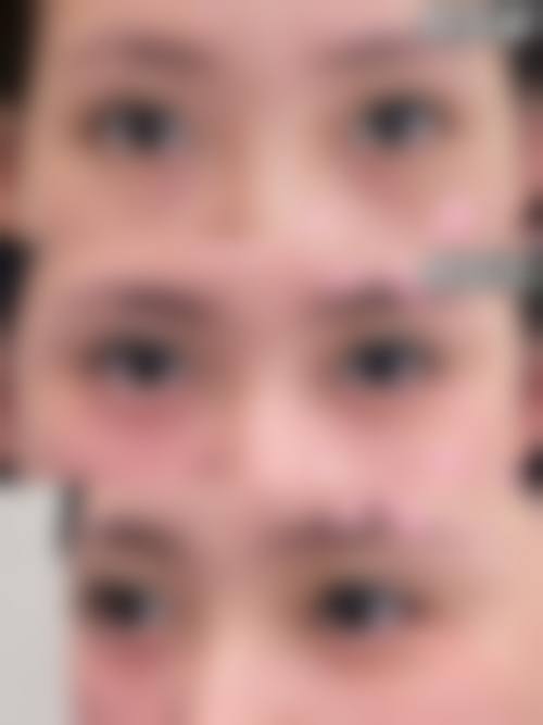 预约优惠活动：郭京玺专属补贴