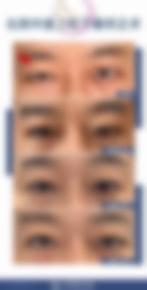 益阳市中 心医院眼科地理位置便于到院。