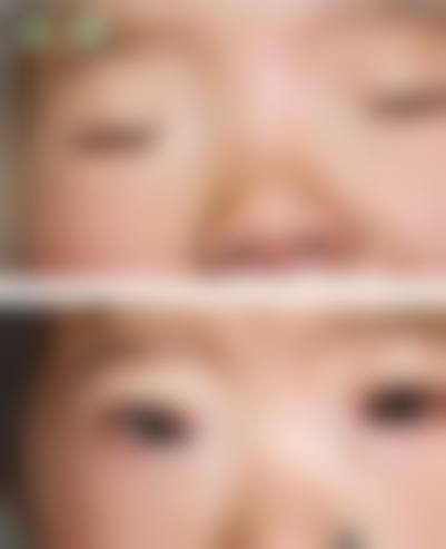 结语:选择威海中康铭熙眼科,守护清晰未来