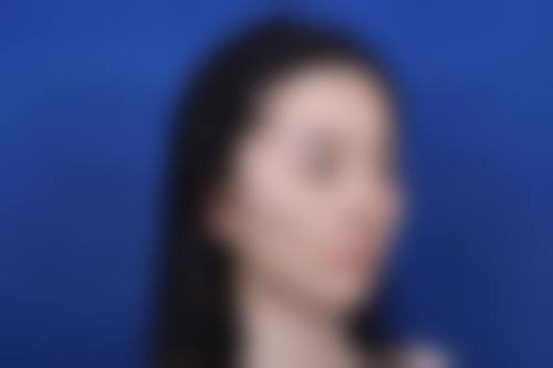 杭州爱度IDO整形美容诊所治疗反馈与口碑评价。
