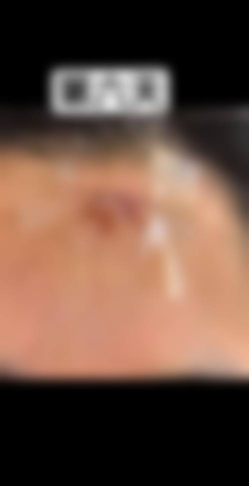 患者真实评价