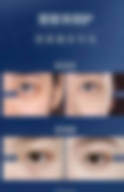 常见问题FAQ
