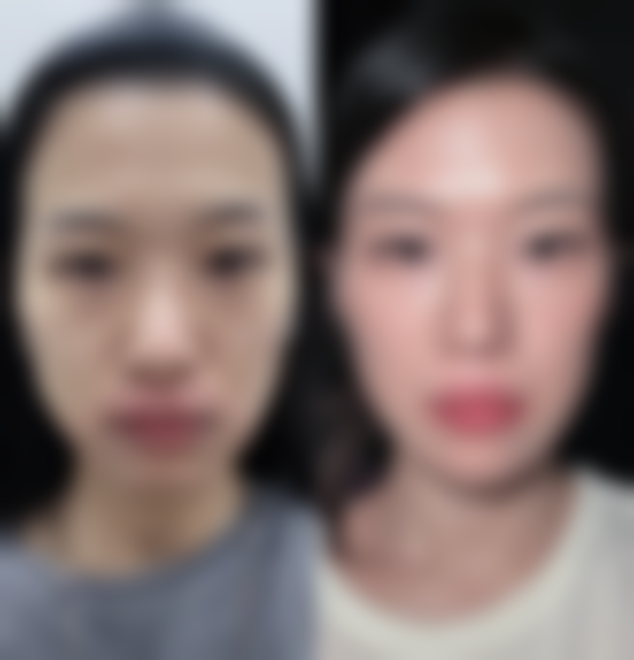 肇庆华美医学整形美容医院擅长项目。