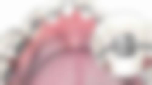宁波恒美口腔门诊部治疗反馈与口碑评价。