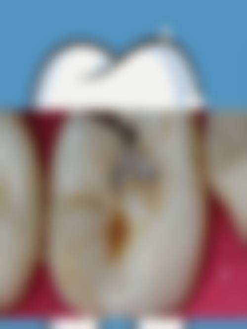 五、优惠活动详情:透明价格,实惠到店