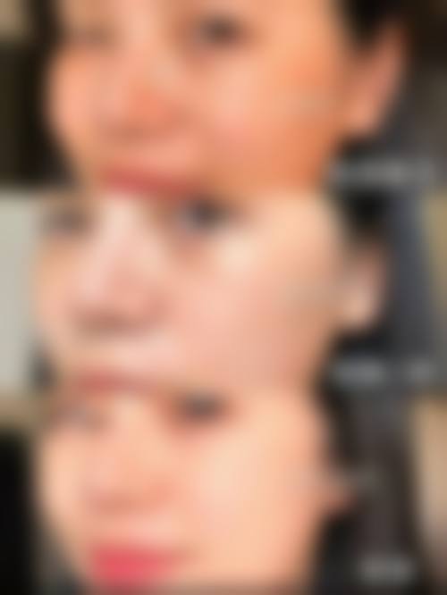 湖北襄阳新艾伊尔医疗美容预约挂号方式。