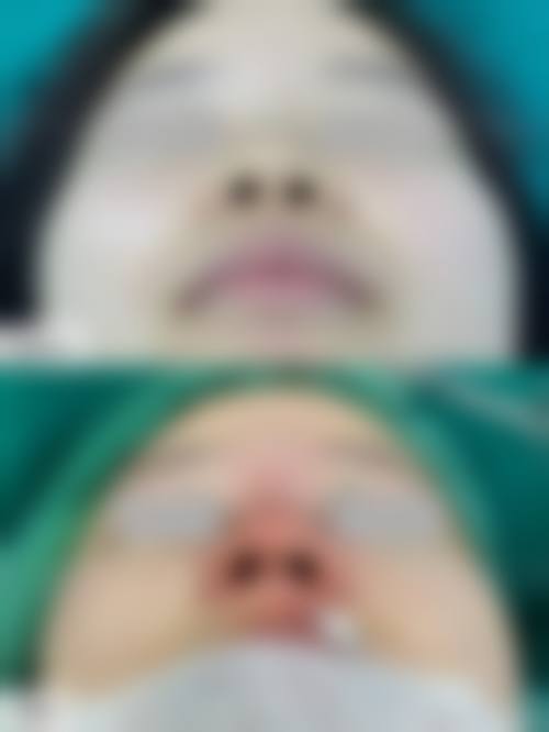 预约优惠活动